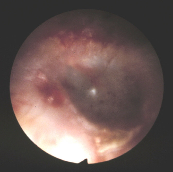 �}��������