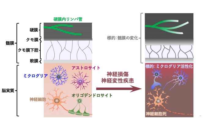 病態時におけるミクログリアの機能