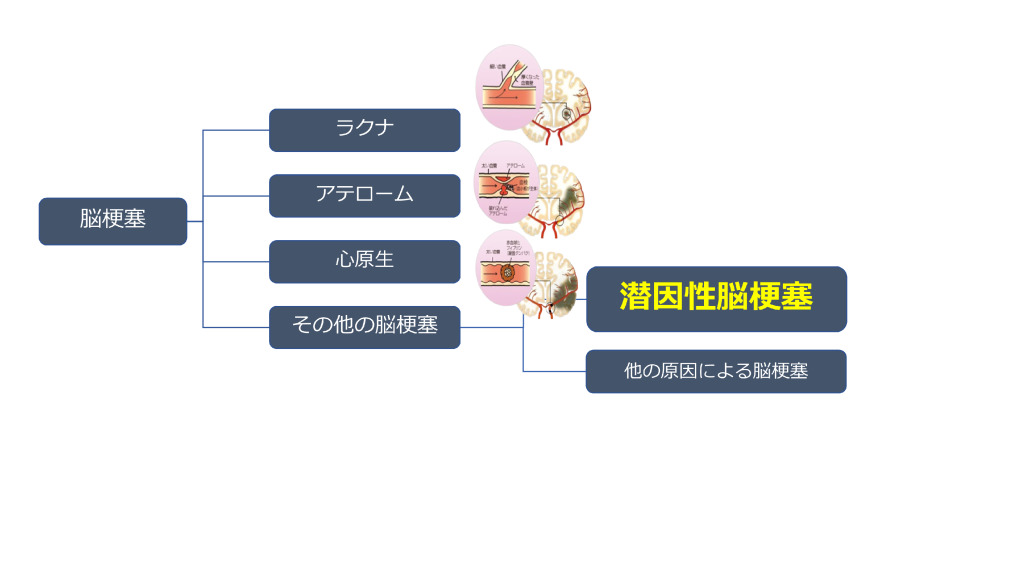 PFOのサムネイル